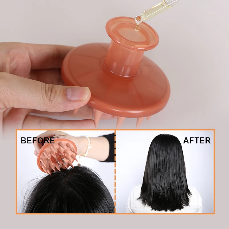 Scalp Oil + Massager Set — view 3
