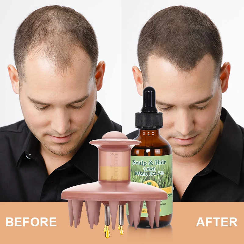 Scalp Oil + Massager Set — view 7